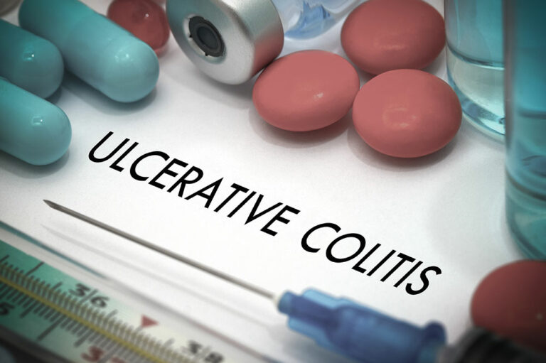 5 Foods That Help Manage Ulcerative Colitis and Crohn’s Disease